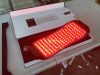 LuxRenew LED Waist Wrinkle Remover Photon Skin Rejuvenation