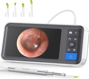 Digital Otoscope with 4.5 Inches Screen, 3.9mm Ear Camera with 6 LED Lights